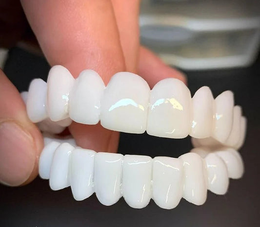 SONRISA PERFECTA - CARILLAS DENTALES INFERIORES Y SUPERIORES