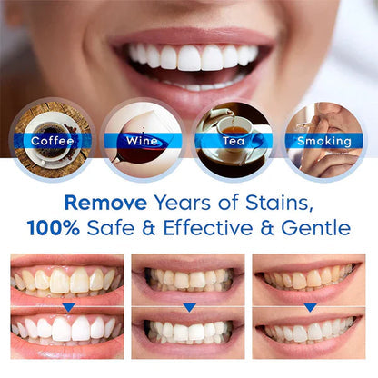 Kit Sonrisa Dazzling White + Palillos Gratis