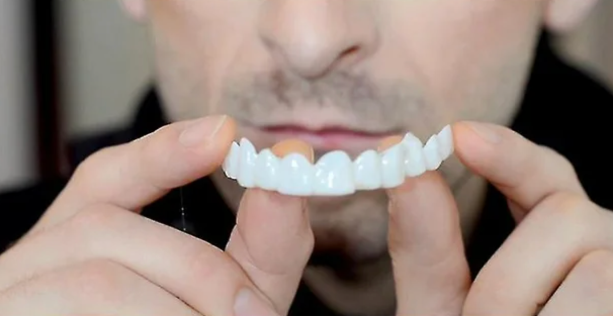 SONRISA PERFECTA - CARILLAS DENTALES INFERIORES Y SUPERIORES