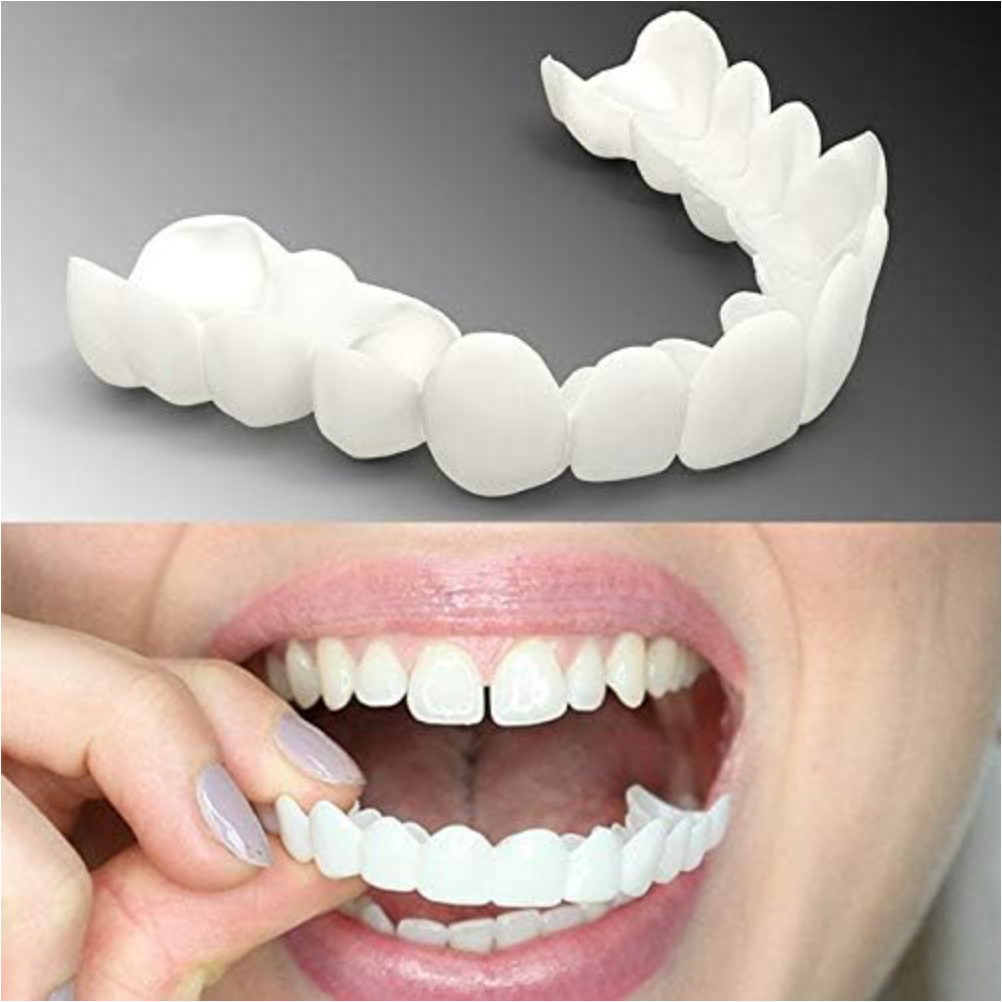 SONRISA PERFECTA - CARILLAS DENTALES INFERIORES Y SUPERIORES