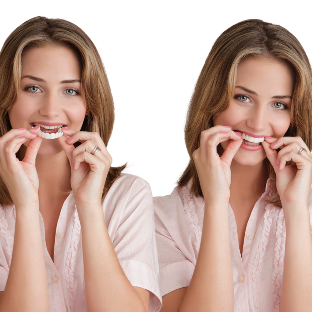 SONRISA PERFECTA - CARILLAS DENTALES INFERIORES Y SUPERIORES