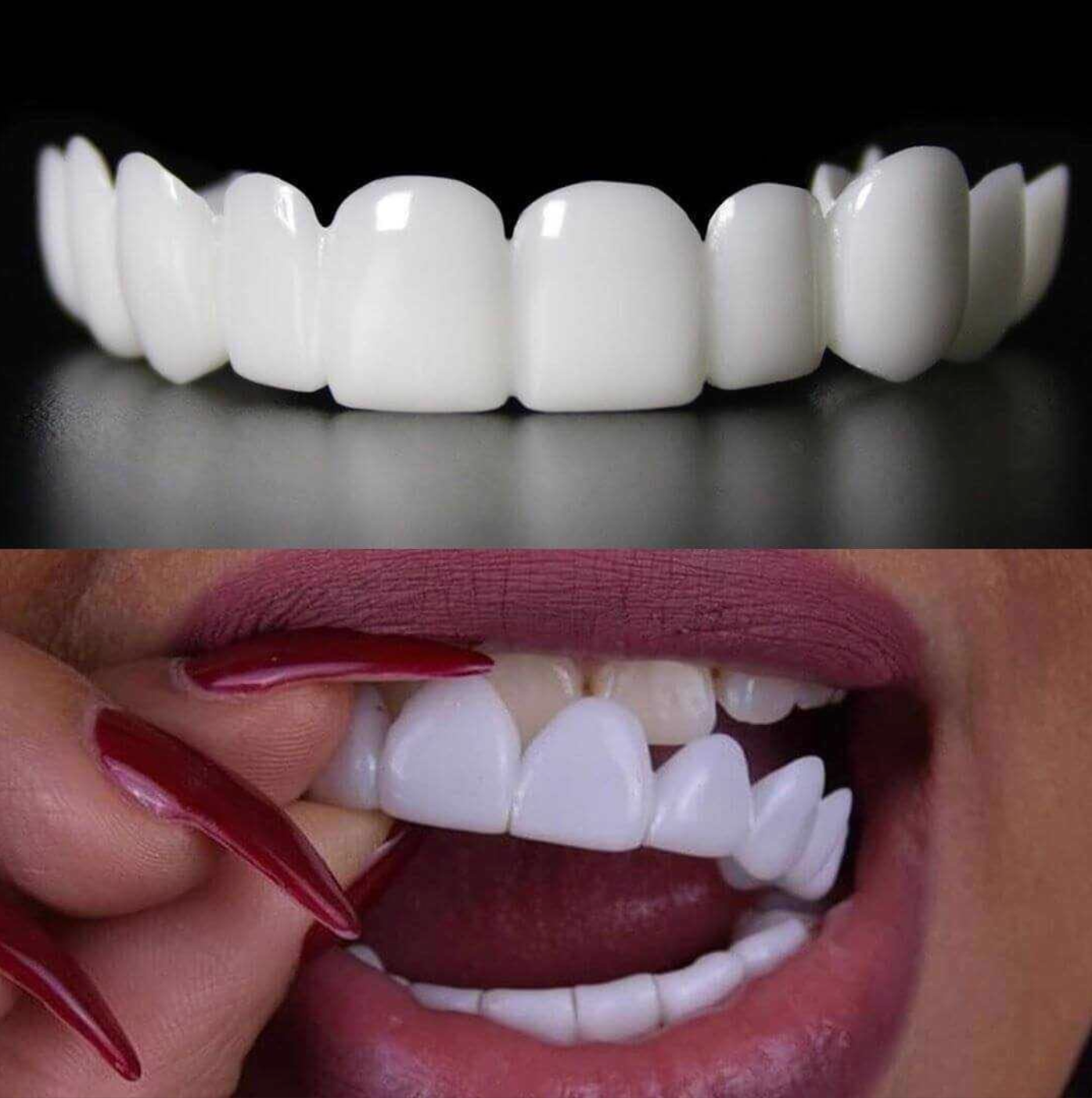 SONRISA PERFECTA - CARILLAS DENTALES INFERIORES Y SUPERIORES