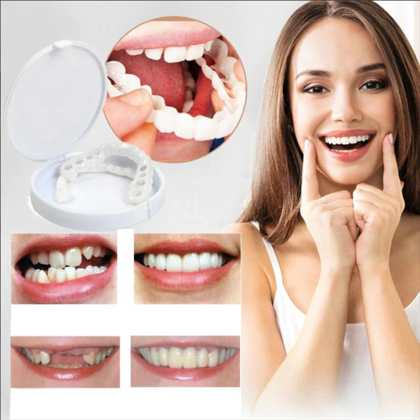 SONRISA PERFECTA - CARILLAS DENTALES INFERIORES Y SUPERIORES