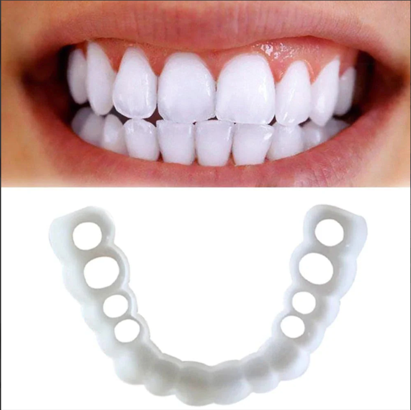 SONRISA PERFECTA - CARILLAS DENTALES INFERIORES Y SUPERIORES