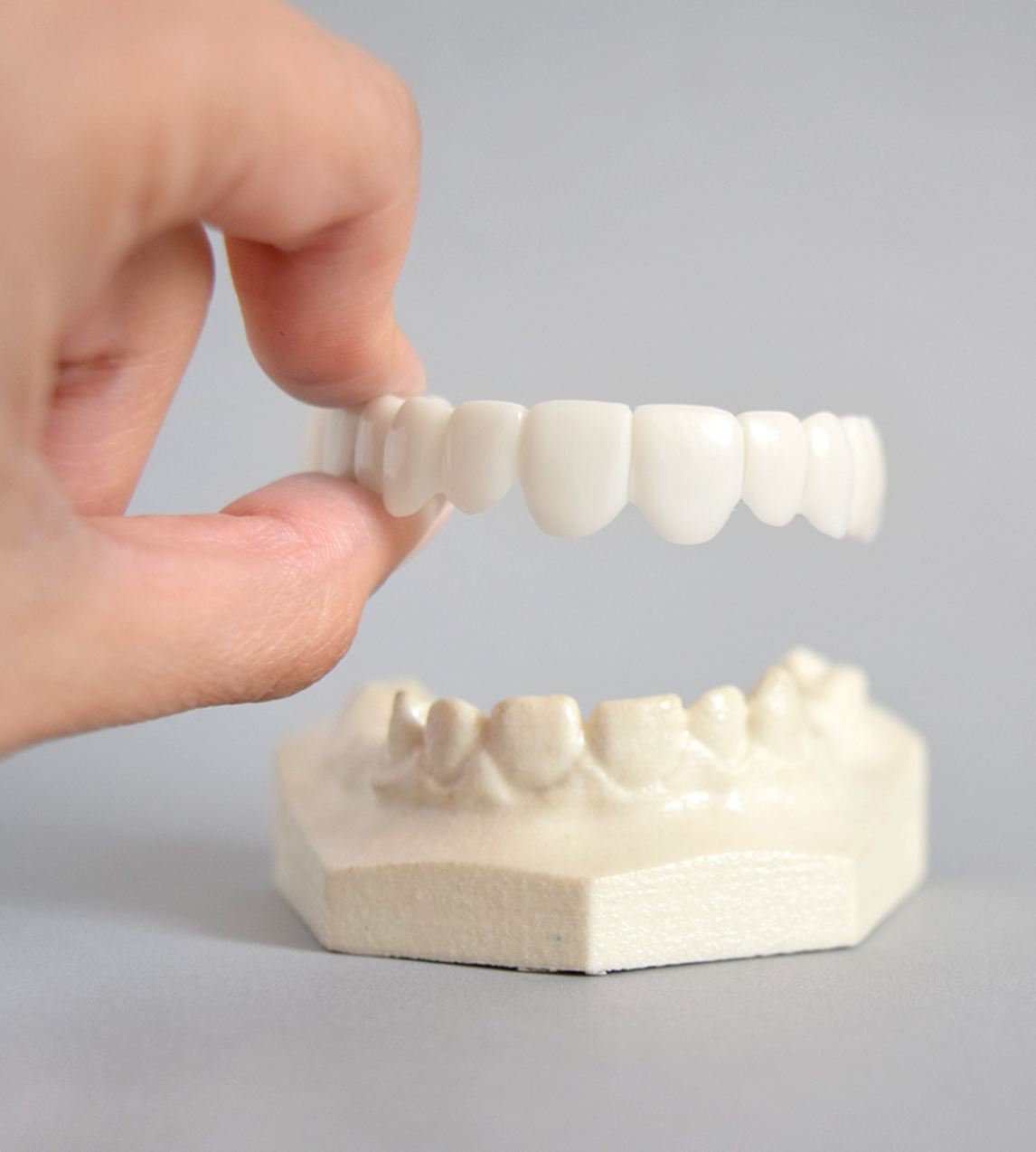 SONRISA PERFECTA - CARILLAS DENTALES INFERIORES Y SUPERIORES