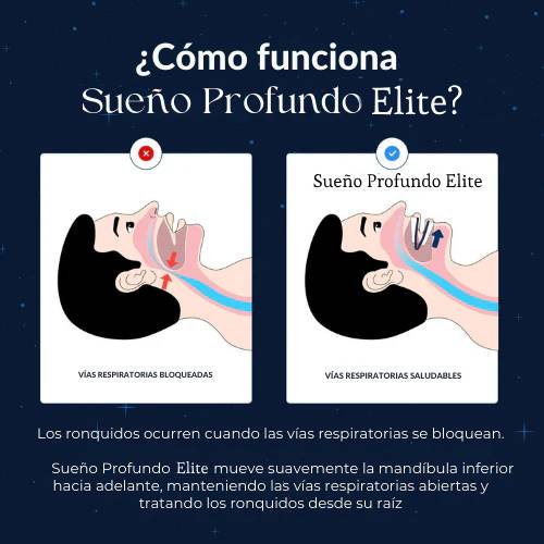 Sueño Profundo Elite™ Dispositivo Bucal Anti-Ronquidos